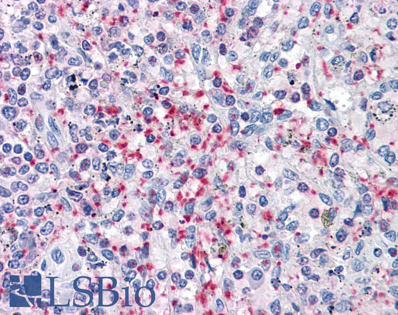 IHC-plus™ PLEK / Pleckstrin Antibody (clone 6E3)