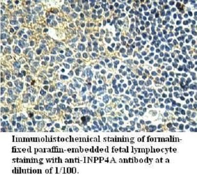 Polyclonal Rabbit anti-Human INPP4A Antibody (aa601-812, IHC, WB)