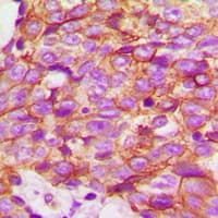TMPRSS3 Antibody (C-Terminus)