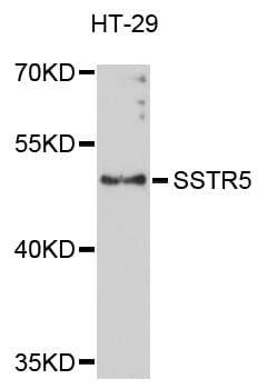 SSTR5 Antibody