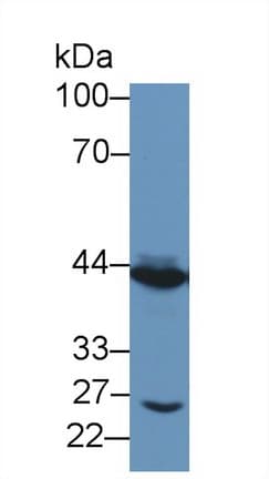 TACR2 / NK2R Antibody (aa92-290)