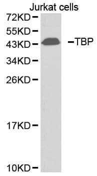 Polyclonal Rabbit anti-Human TBP / GTF2D Antibody (IHC, WB)