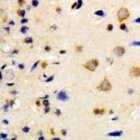 NEK7 Antibody (Internal)