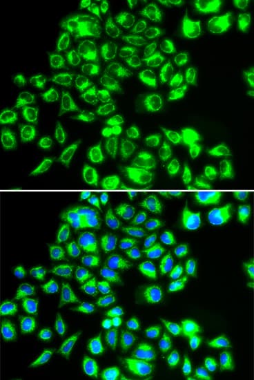 Polyclonal Rabbit anti-Human AIFM1 / AIF / PDCD8 Antibody (IHC, IF, WB)