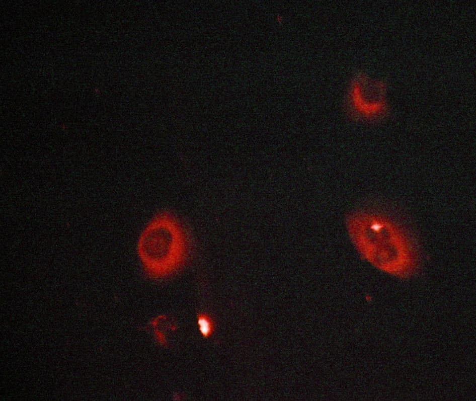 MMP8 Antibody