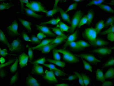 Polyclonal Rabbit anti-Human SNRPE Antibody (IHC, IF, WB)