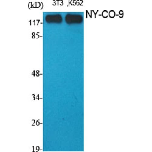 HDAC5 Antibody (1050-1130 aa, C-terminal)