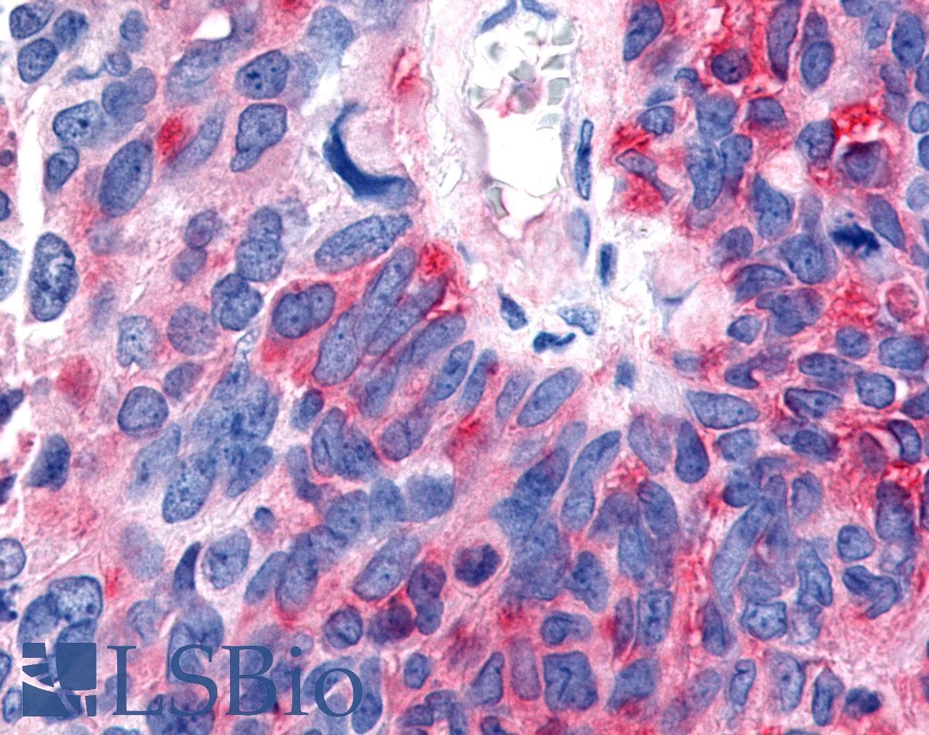 PathPlus™ RORB / ROR Beta Antibody (Hinge Domain)
