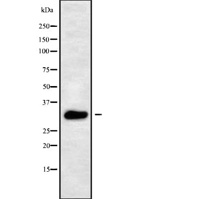 AQP10 / Aquaporin 10 Antibody