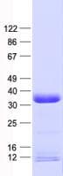 Human SLC25A27 / UCP4 Protein (Recombinant His, N-Terminal)