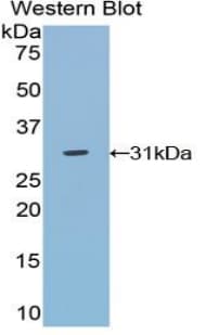 TRADD Antibody (aa21-259)