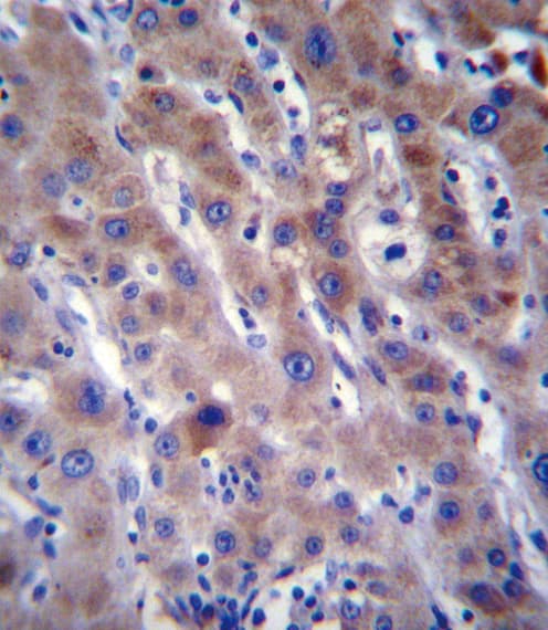 Delta-6 Desaturase / FADS2 Antibody (aa79-108)