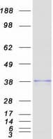 Human EXTL2 Protein (Recombinant Myc-DDK (Flag))
