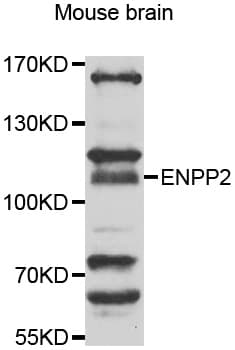 Polyclonal Rabbit anti-Human ENPP2 / Autotaxin Antibody (WB)