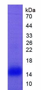 Rat LF / LTF / Lactoferrin Protein (Recombinant His)