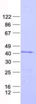 Human PSKH2 Protein (Recombinant His, N-Terminal)