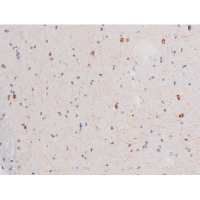 LIMK2 Antibody (phospho-Ser283)