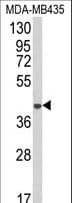 AGPAT4 Antibody (aa176-202)