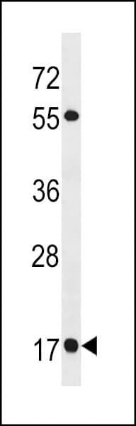Polyclonal Rabbit anti-Human RAB19 Antibody (aa1-30, WB)