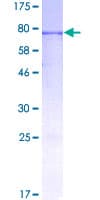 Human INHBA / Inhibin Beta A Protein (Recombinant GST)
