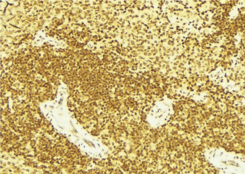 Polyclonal Rabbit anti-Human FANCD2 Antibody (phospho-Ser222, IHC, IF, WB)