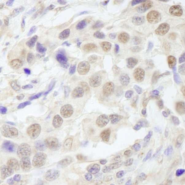 Polyclonal Rabbit anti-Human TAFII70 / TAF6 Antibody (aa627-677, IHC)