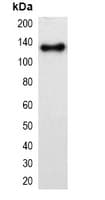 mOrange Tag Antibody