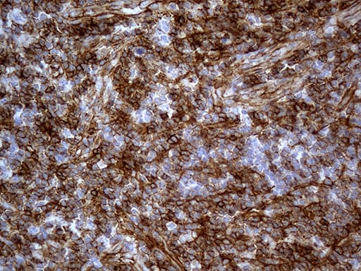 CD99 Antibody (clone OTI1A1)