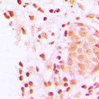 CREBBP / CREB Binding Protein Antibody (Internal)
