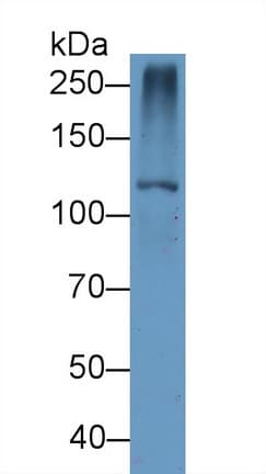TYK2 Antibody (aa667-914, APC)