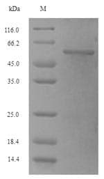 Escherichia coli DBP5 / SON Protein (Recombinant 6His-SUMO, N-terminus)