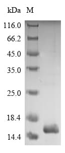 Dermatophagoides pteronyssinus DERP2 Protein (Recombinant 6His, N-terminus)