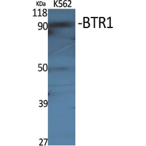 SLC4A11 / NABC1 Antibody (260-340 aa, Internal)