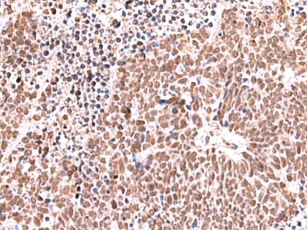 RCOR3 Antibody