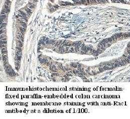 RAC1 Antibody