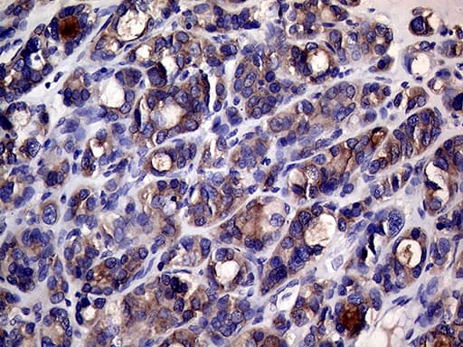 SLC9A1BP / CHP Antibody (clone OTI1D11, Carrier-free)