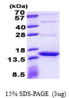 Streptomyces Streptavidin Protein (Recombinant His)