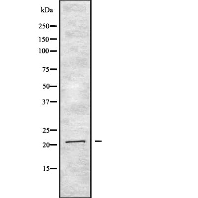Polyclonal Rabbit anti-Human IFNA2 / Interferon Alpha 2 Antibody (IHC, WB)