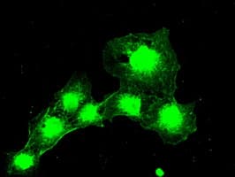 BUB1B / BubR1 Antibody (clone OTI5D9)
