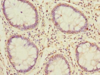 MSRB2 / MSRB Antibody