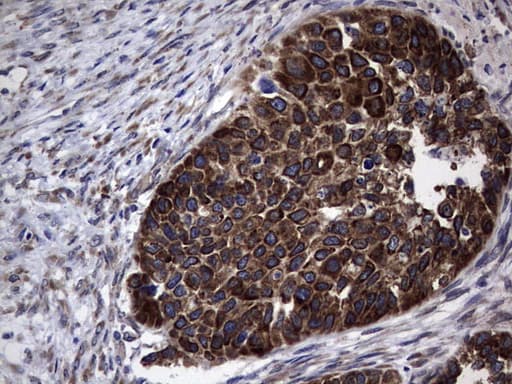 MTDH / Metadherin Antibody (aa70-582, clone OTI1B6)