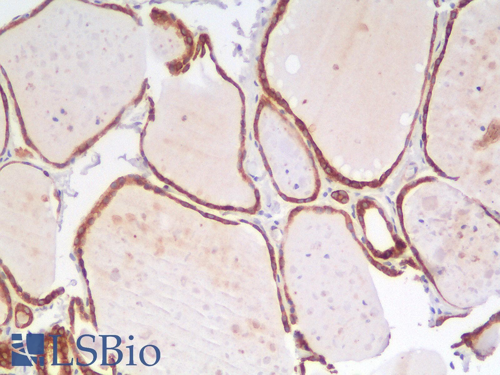 PathPlus™ BCL2 / Bcl-2 Antibody (clone rBCL2/796)