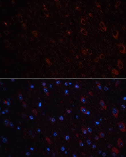 TH / Tyrosine Hydroxylase Antibody