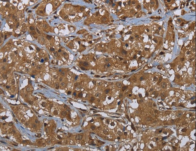 GCK / Glucokinase Antibody