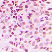 Polyclonal Rabbit anti-Human NKX3-1 Antibody (N-Terminus, IHC, WB)