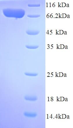 Human IL12RB2 Protein (Recombinant 6His, N-terminus)
