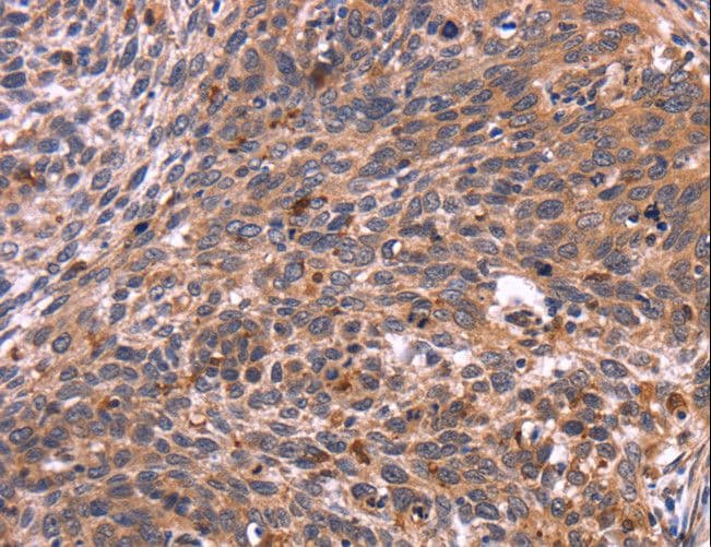 Polyclonal Rabbit anti-Human CRK Antibody (IHC)