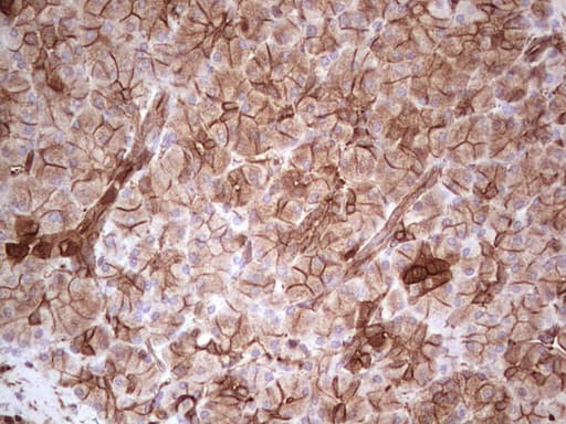 LGALS9 / Galectin 9 Antibody (clone OTI1D12)