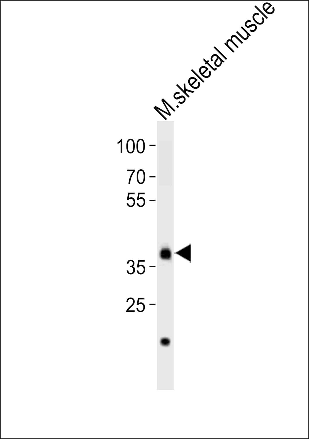 DBX1 Antibody (aa261-295)