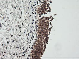 CDKN2B / p15 INK4b Antibody (clone OTI8H4, Carrier-free)